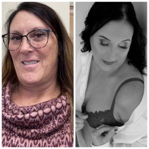 Woman that is 54 years old's before and after